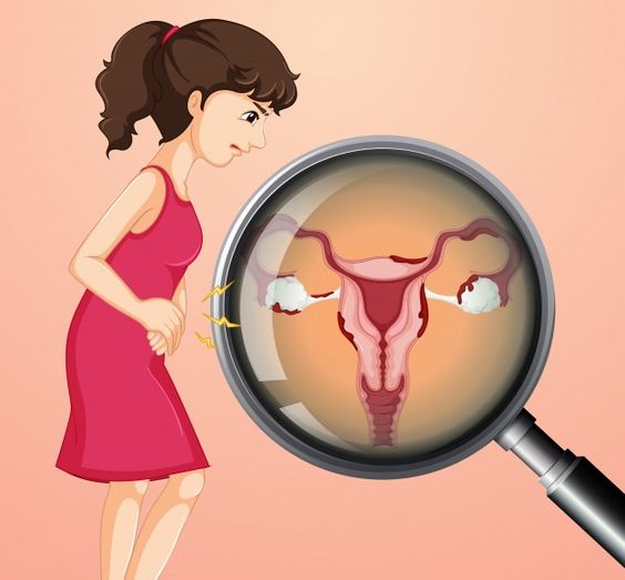 Conmemora la Secretaría de Salud el Día Mundial del Cáncer de Ovario
